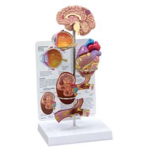 Zestaw na nadciśnienie