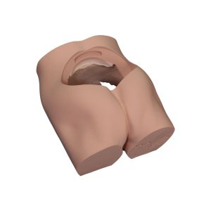 Wymiana skorupy korpusu