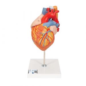 Human Heart Model with Esophagus and Trachea, 2 times Life-Size, 5 part - 3B Smart Anatomy