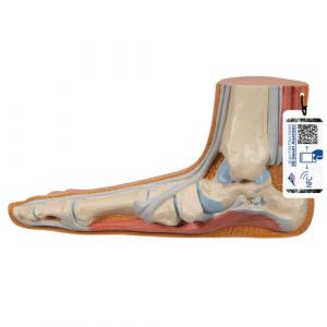 Flat Foot (Pes Planus) Model - 3B Smart Anatomy