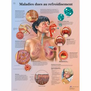 Maladies dues au refroidisement