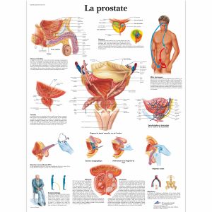 La prostata