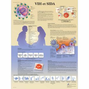 HIV i SIDA