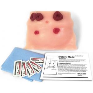 Ostomy Care Model