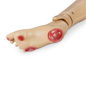 Geri i KERi Pressure Ulcer Foot