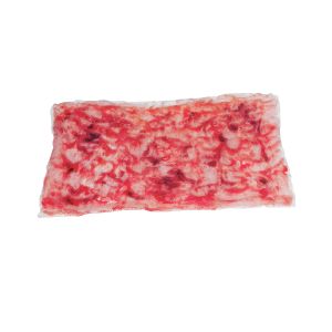 Symulowane indywidualne zwijanie oparzenia - głęboka częściowa grubość 2. stopnia